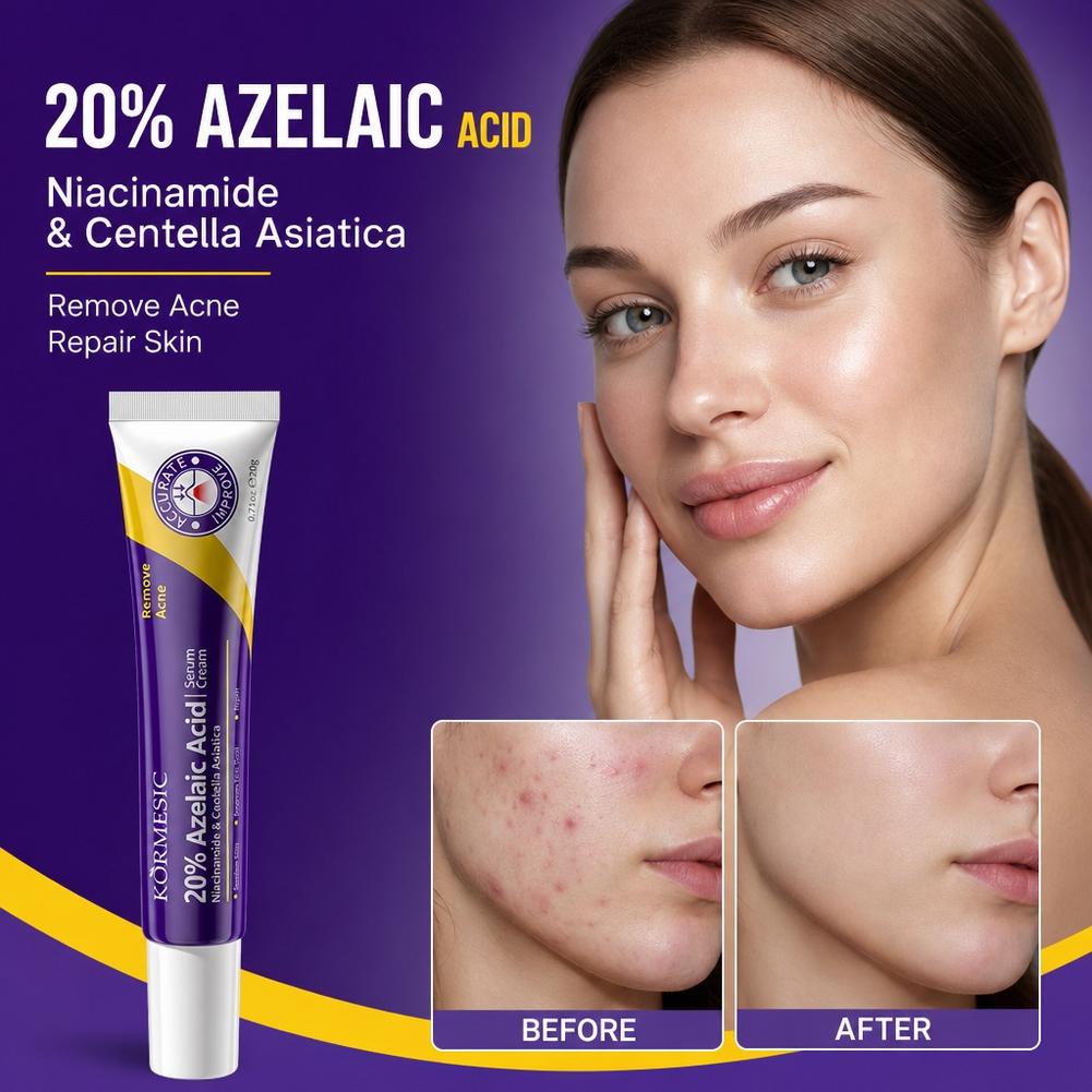 Crema viso idratante profonda  - Azelaic Acid Cream recensione e prezzo