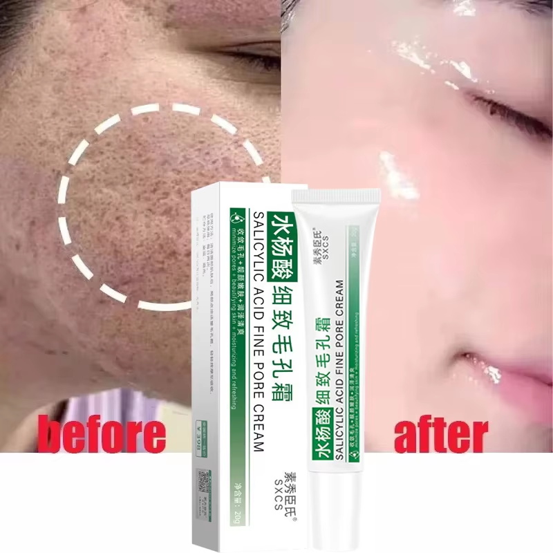 Crema restringente dei pori al - Azelaic Acid Cream recensione e prezzo